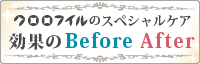 効果のBeforeAfter